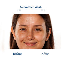 Blue Nectar Vitamin C Face Wash for Women and Men | Anti Acne Face Wash with Neem & Honey | Natural Cleanser for Face with Ayurvedic Herbs (11 Herbs, 200 ml)