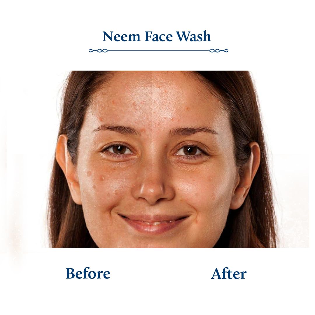 Blue Nectar Vitamin C Face Wash for Women and Men | Anti Acne Face Wash with Neem & Honey | Natural Cleanser for Face with Ayurvedic Herbs (11 Herbs, 200 ml)
