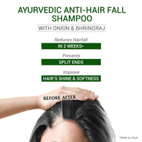 SESA Ayurvedic Anti Hairfall Shampoo For Dry And Frizzy Hair Reduces Hairfall Made With 6 Ayurvedic Herbs Paraben Free Shampoo - 500ml