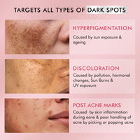 mCaffeine 2% Kojic Acid & 1% Niacinamide De-Pigmentation Cream| Reduces Dark Spots, Melasma, Tan & Evens skin tone |Skin Brightening Lightweight Moisturizer For Men & Women | For All Skin Types- 50g