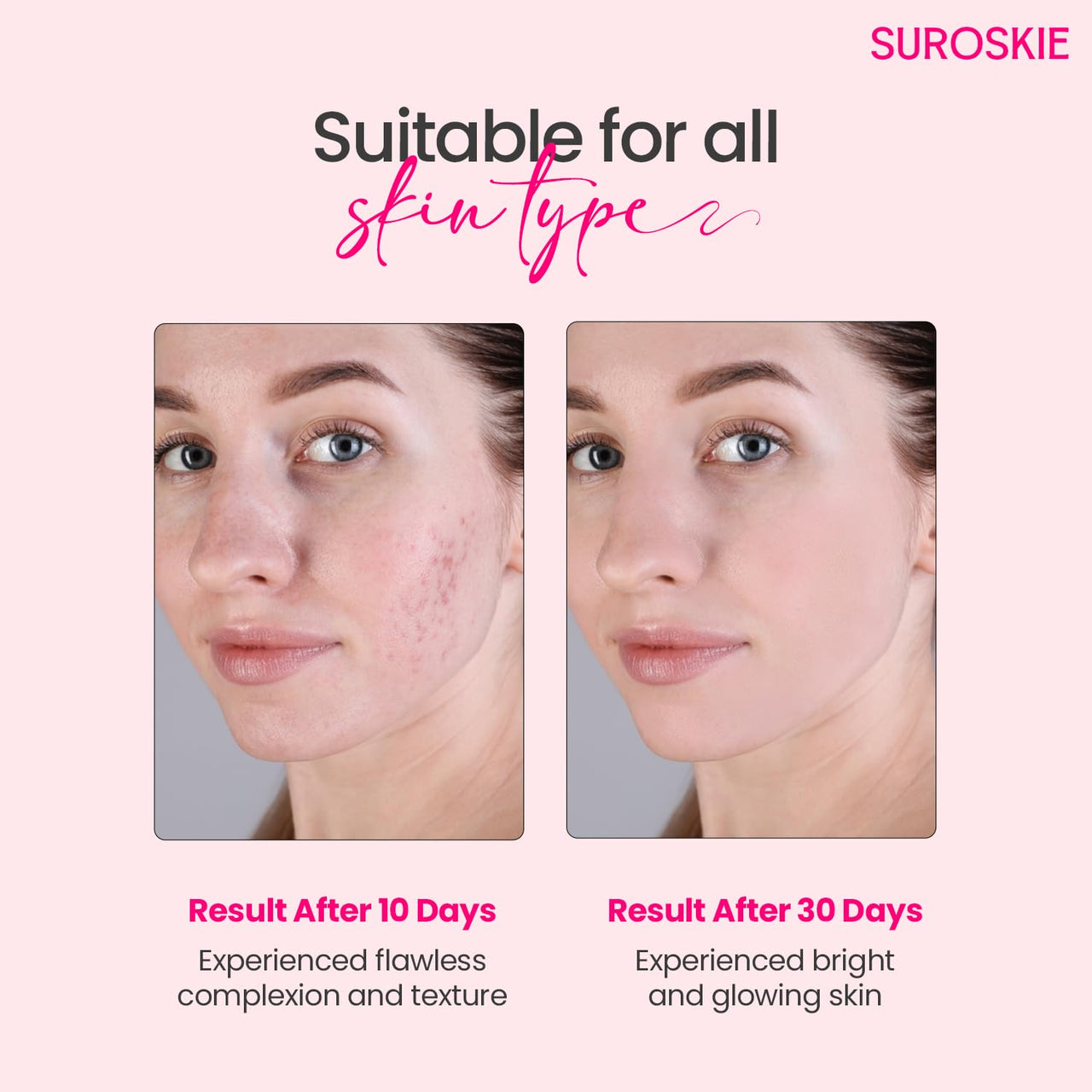 Suroskie Rosanna Rose Instant Glow Face Mask 50Ml | With Rose & Aloe Vera | For Cleans Pores & Dark Spot | Spa Glow At Home | Facial In A Jar | Korean Face Mask For Glowing Skin |Men & Women