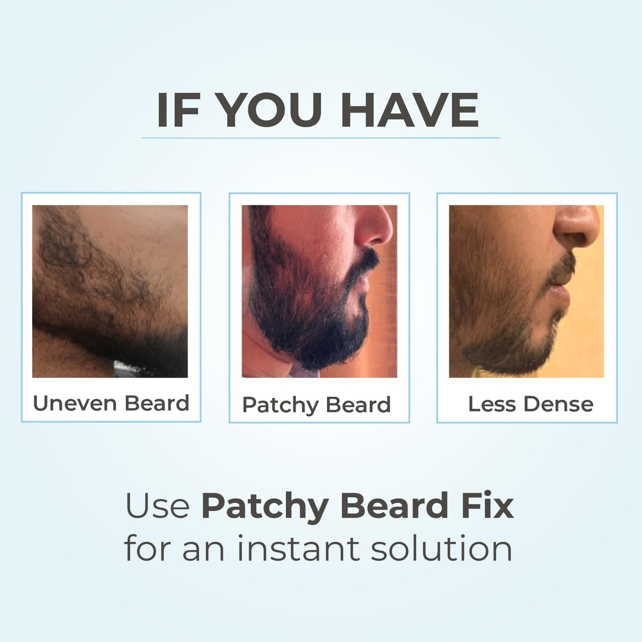 Rise for Men Patchy Beard Fix | Apply in One minute | Natural Look | Smudge & Water Proof | No Side Effects | Alternative to Beard Growth Oils and Serums