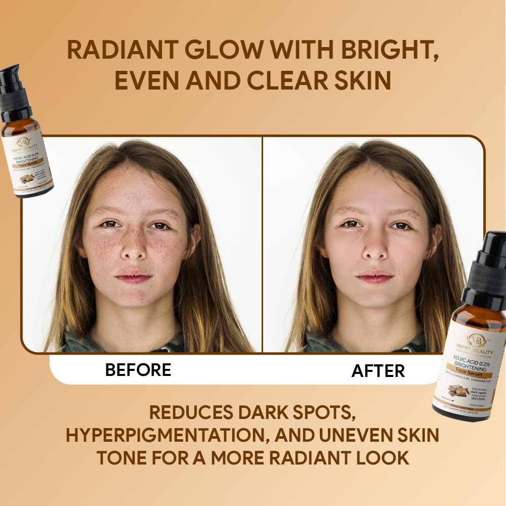 Vamp Beauty Kojic Acid 0.2% Brightening Face Serum | With Licorice 0.3% & Tangerine 0.2% | Reduces Dark Spots & Pigmentation | For Glowing Skin & Even Tone | All Skin Types | 30ml