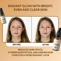 Vamp Beauty Kojic Acid 0.2% Brightening Face Serum | With Licorice 0.3% & Tangerine 0.2% | Reduces Dark Spots & Pigmentation | For Glowing Skin & Even Tone | All Skin Types | 30ml