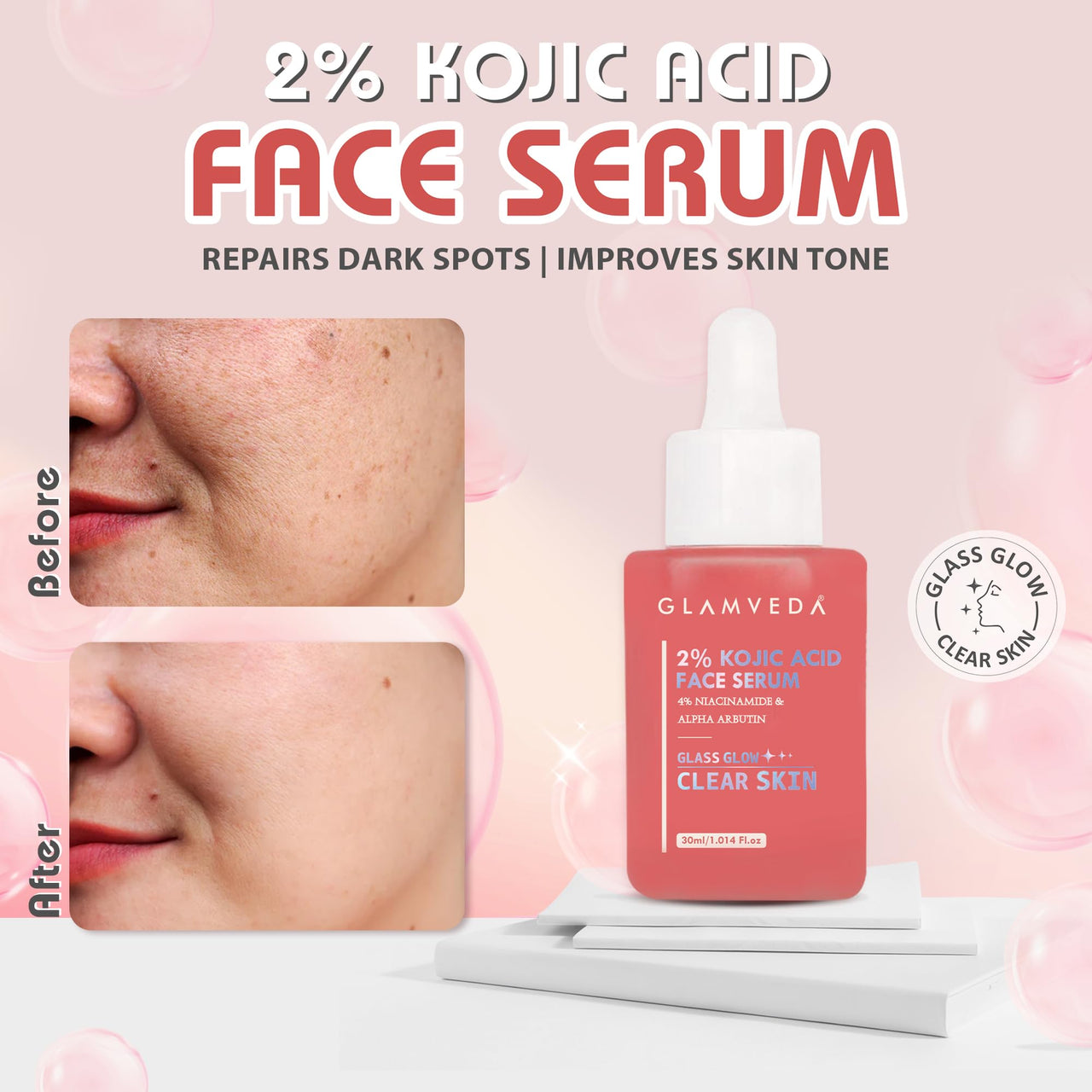 Glamveda 2% Kojic Acid Face Serum with Niacinamide & Alpha Arbutin | Skin Brightening & Hydration | Dark Spot, Blemish & Wrinkle Reduction | Glass Skin Glow | All Skin Types