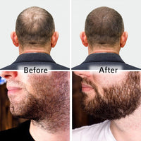 ORGATRE Hair Growth Serum 2.0-30ml | For Beard & Scalp | Reduces Hairfall & Thinning | 1.5% Aminexil, Redensyl, Anagain & Procapil | Hair Growth Serum for Men & Women