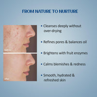 Suun Ayurveda Anti-Acne Face Serum for Pimples, Blackheads & Acne Scars | With 2% Encapsulated Salicylic Acid, 5% Niacinamide, Coffee Leaf & Red Clove Oil | Controls Oil, Clears Skin & Soothes Inflammation | 30 ml