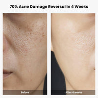 THE SOLVED SKIN India’s 1st Derma Tested Barrier Repair Gel Moisturiser With Lamellar Liquid Technology Reverses 4 Signs of Skin Damage by 70% Within 4 Weeks. 48 Hours Hydration. 50ml