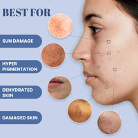 WildOak 5% Vitamin C & Niacinamide Brightening Face Moisturizer | Reduces Acne Scars, Hyperpigmentation & Dullness | Repairs & Hydrates Skin | Lightweight, Non-Greasy Formula | 100ml