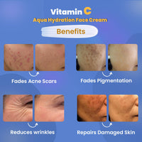 WildOak 5% Vitamin C & Niacinamide Brightening Face Moisturizer | Reduces Acne Scars, Hyperpigmentation & Dullness | Repairs & Hydrates Skin | Lightweight, Non-Greasy Formula | 100ml