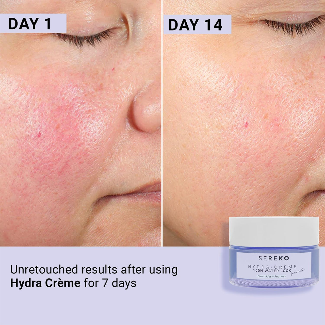 SEREKO Hydra Creme Ceramide Moisturizer, Skin Barrier Repair Cream, Long Lasting Hydration Up To 100 Hours, Locks Moisture, With Peptide, Lightweight Gel Formula, All Skin Types, For Men & Women, 50ml