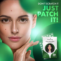 Urban Yog Acne Pimple Patch For Face | 36 Facial Stickers for Active Acne | Absorbs Pimple Overnight | Suitable for All Skin Types