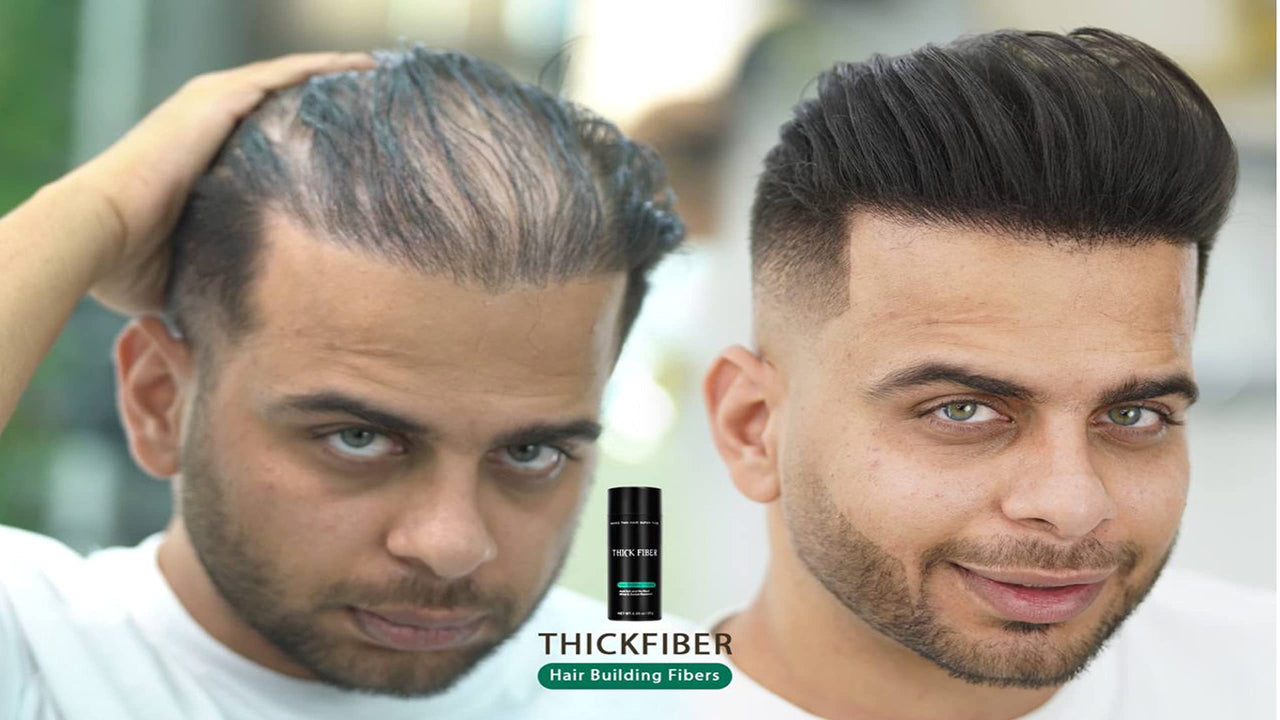 THICK FIBER Hair Building Fibers (Black) 12g - Hair Fibres For Thin & Bald Spots - Thickening Fibers For Men & Women (12g Pack of 1)