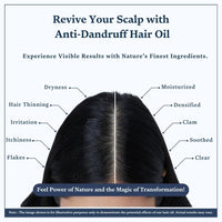 Singular Anti Dandruff Hair Oil for Men & Women - Pure & Natural Cold Pressed Hair oil for Dandruff and Hairfall for Scalp Microbiome Balance with Tea Tree, Peppermint & More Hair Oil - 200 ml