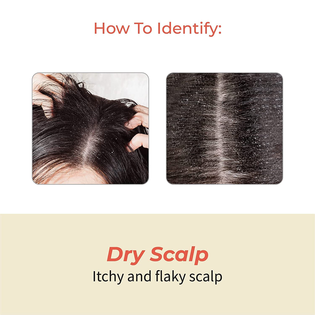 Vedix Customised Ayurvedic Hair Fall Oil | Vedix Shvedan Hair Fall Oil | For Dry Scalp | With Castor + Sesame + Olive | For Reducing Hair Fall | For Hair Growth | -100ml