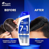 Head & Shoulders 7in1 Anti-dandruff Shampoo | Multi-action formula | Complete Solution for unhealthy scalp | 7 benefits for Men and Women, 650ml