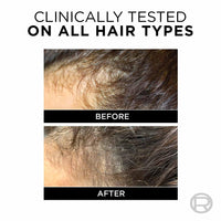 L'Oreal Paris Fall Resist 3X Anti-Hairfall Shampoo, 75ml (With 10% Extra)