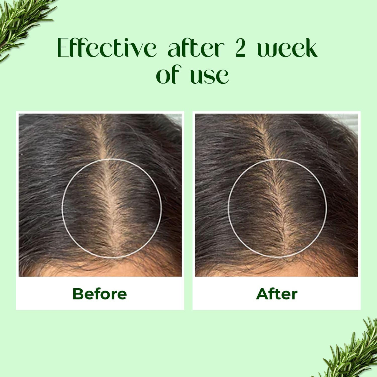 Passion Indulge's Rosemary Hair Growth Kit by Passion Indulge - Rosemary Hair Growth Hair Oil, Serum & Anti Hair Fall Conditioning Shampoo