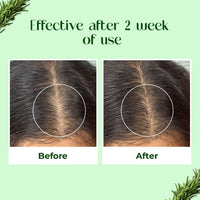 Passion Indulge's Rosemary Hair Growth Kit by Passion Indulge - Rosemary Hair Growth Hair Oil, Serum & Anti Hair Fall Conditioning Shampoo