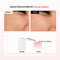 Mirabelle Korea Hong Ssal Red Rice Refresh Water Toner 150 ml | Tightens Pores & Moisturize | Women & Men | Korean Skincare