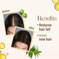Kesh King Ayurvedic Oil for Hair Fall Control | Reduces Hairfall and Supports New Hair Growth | 21 Ayurvedic Herbs | 100ml