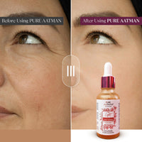 Pure Aatman Tea Tree Face Serum with 20% Vitamin C Effective with & Lotus Oil for Glowing Skin, Pigmentation, Acne Control, Dark Spot Reduction & Anti-Aging Only Natural Ingredient Used For Both Men & Women
