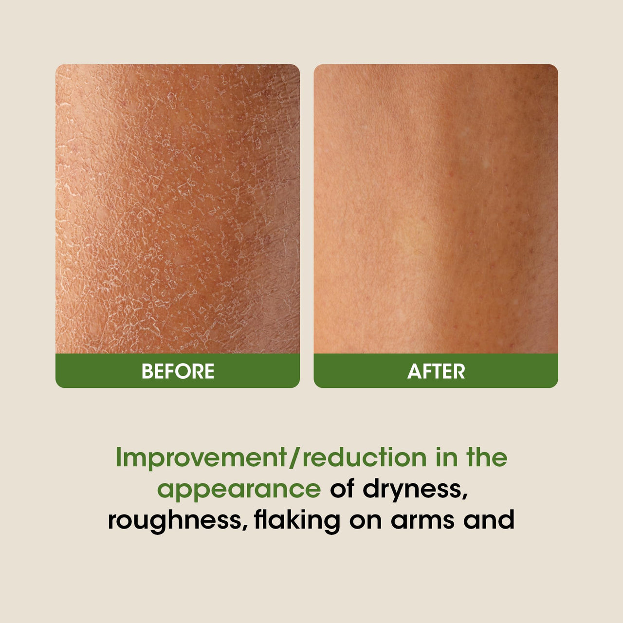 OG Beauty Science+ SPF 30 Body Lotion | Hydrating & Nourishing Formula with Aloe Vera, Vitamin E & Glycerine | Broad-Spectrum Sun Protection | Lightweight, Non-Greasy Moisturizer for All Skin Types – 350ml