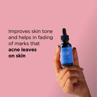 ZM Zayn & Myza 10% Niacinamide Serum With Zinc | Face Serum for Acne Marks, Blemishes, Pigmentation & Oil Control | Serum For Pimples & Acne Prone Skin - 30 ml