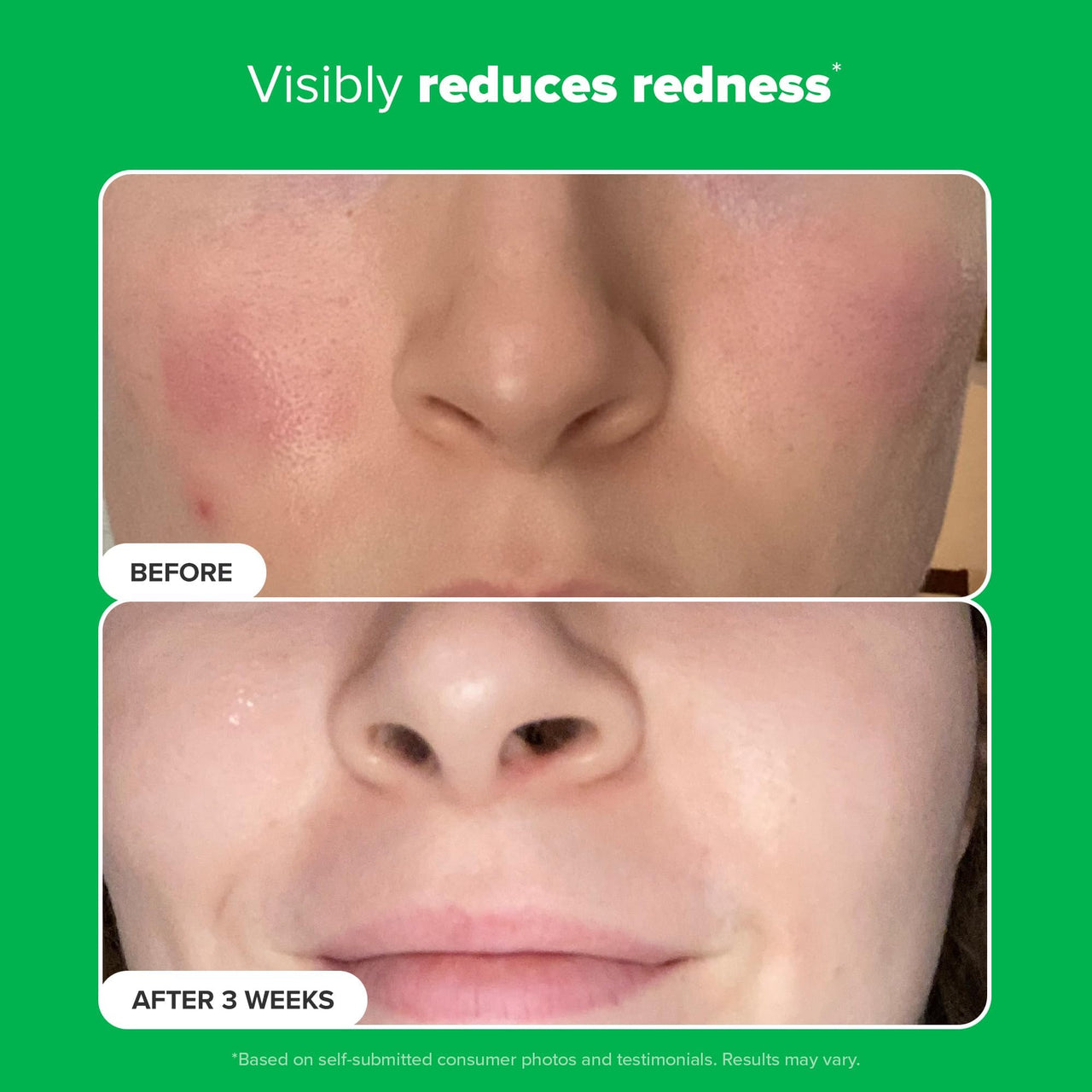 Paula's Choice BOOST 10% Azelaic Acid Booster Cream Gel Face Serum with Salicylic Acid, Oil-Free Skin Brightening Serum for Face, Fragrance-Free - 5 ml