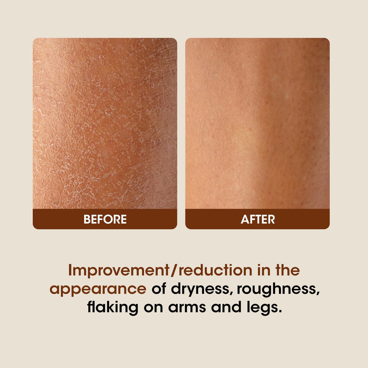 OG BEAUTY SCIENCE+ AHA BHA Body Lotion with Shea & Cocoa Butter | Lightweight, Non-Greasy Hydration | Gently Exfoliates for Smooth & Radiant Skin | Vitamin E & Glycerine for All Skin Types | 350ml