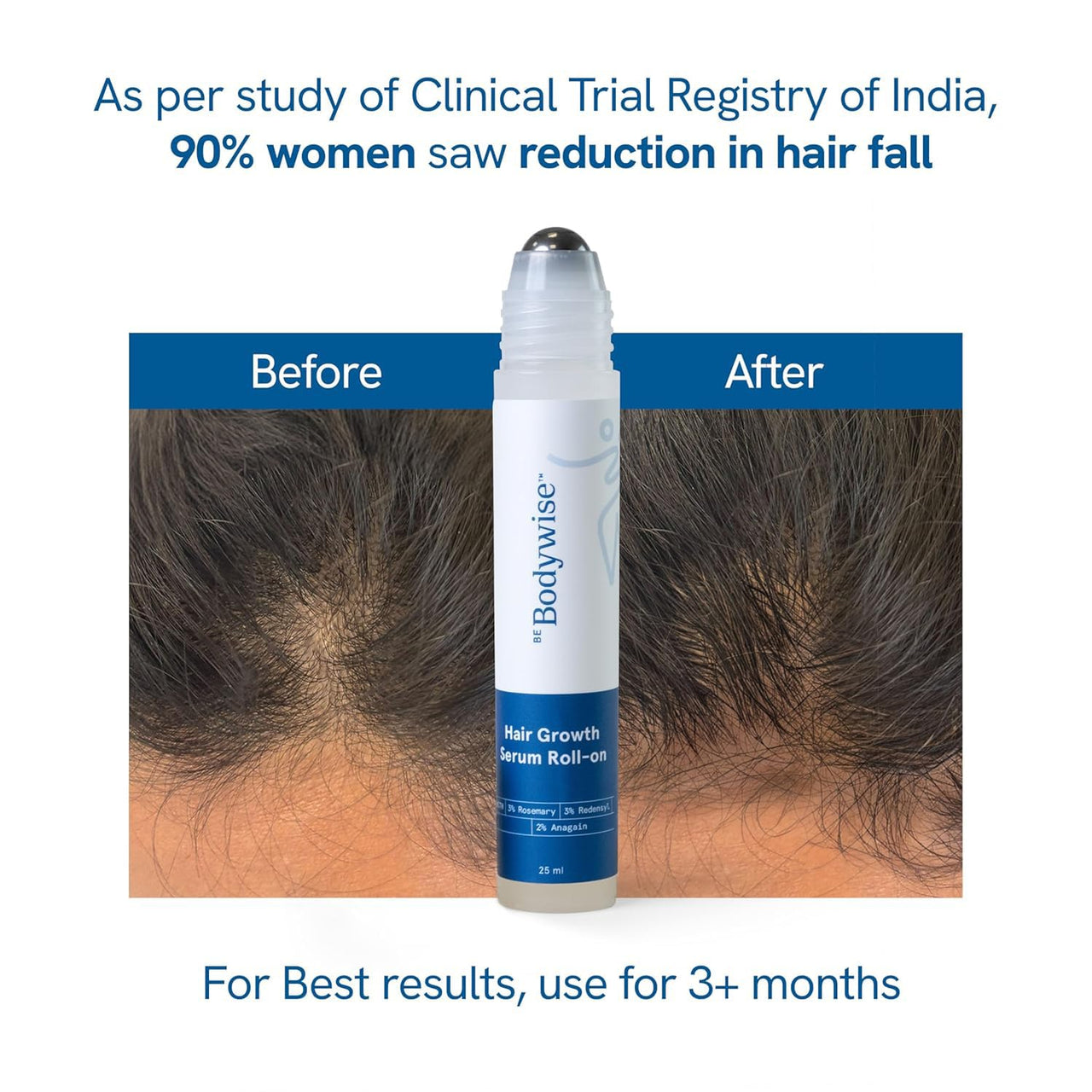 Be Bodywise 3% Redensyl & Rosemary Hair Growth Serum (Roll On) | Pack of 2 |with 2% Anagain | Thicker & Stronger Hair | Prevents Hairfall & Stimulates Hair Follicles | For All Hair Types | 50ml