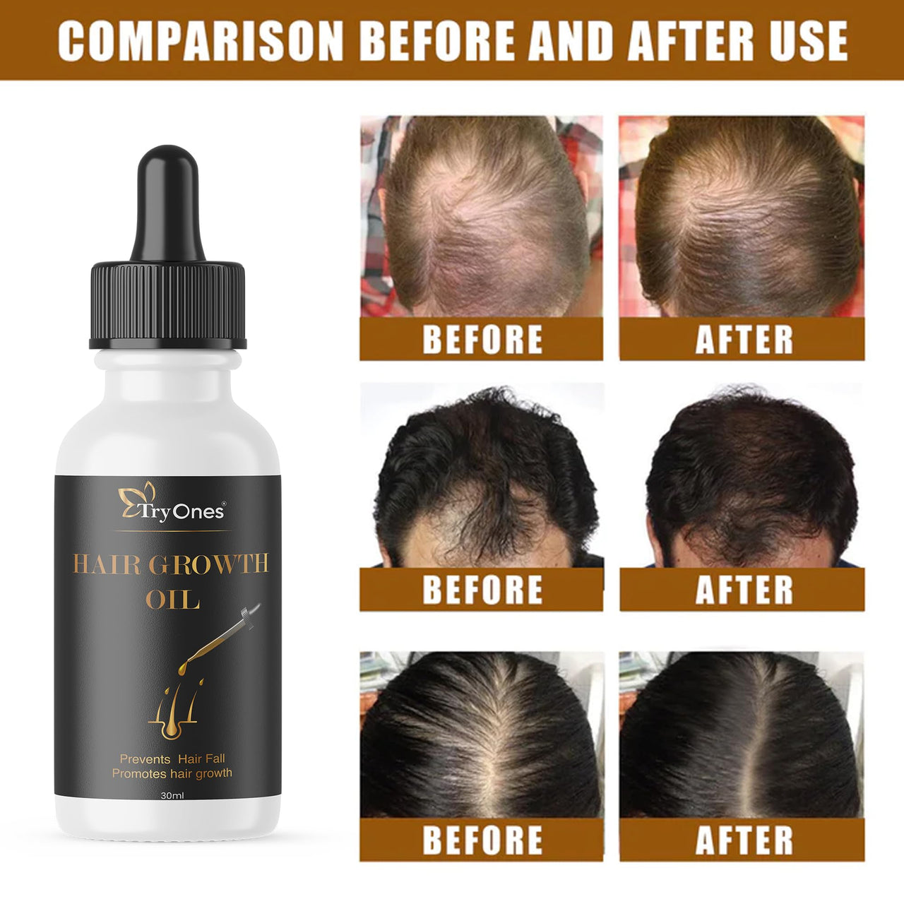 TryOnes Professional Hair Serum for Frizzy Hair||Serum for Women & Men||All Hair Types for Frizz-free, Smooth & Glossy Hair||Hair Growth Oil Serum_30ML
