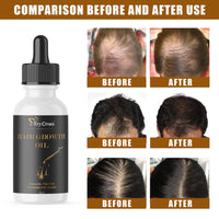 TryOnes Professional Hair Serum for Frizzy Hair||Serum for Women & Men||All Hair Types for Frizz-free, Smooth & Glossy Hair||Hair Growth Oil Serum_30ML