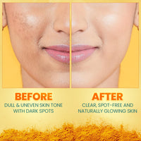 Himalaya Dark Spot Clearing Turmeric Kit (Pack Of 3) | 100% Organically Sourced Svarasa Turmeric | Free Jute Bag | Face Wash 100 Ml | Face Pack 100 Gm | Serum 30 Ml