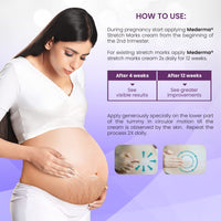 Mederma Stretch Marks Therapy | Stretch Mark Cream For Women & Men | Anti stretch mark cream during & After pregnancy (50g)
