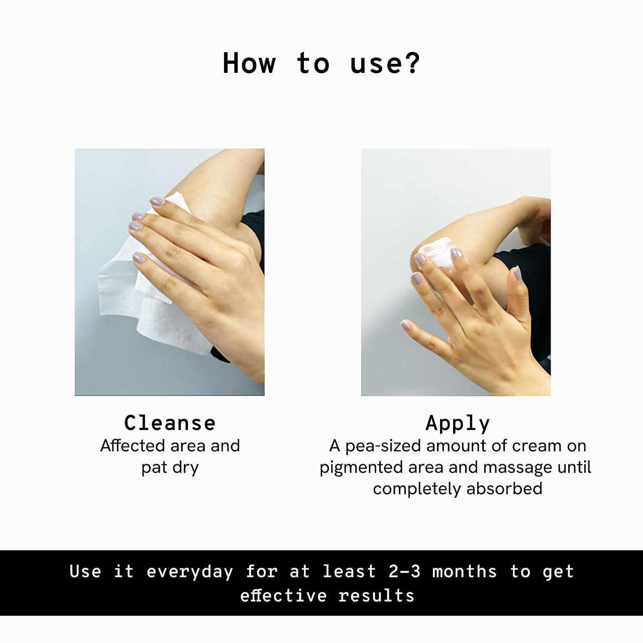 Be Bodywise Pigmentation Cream 100gm | 2.5% Lactic Acid, 2% Urea, Retinol & Kojic Acid | Reduces Tan, Pigmentation & Evens Skin Tone | Treats Dark Patches & Rough Skin on Elbows, Knees, Back of Neck & Thighs | For Daily Use