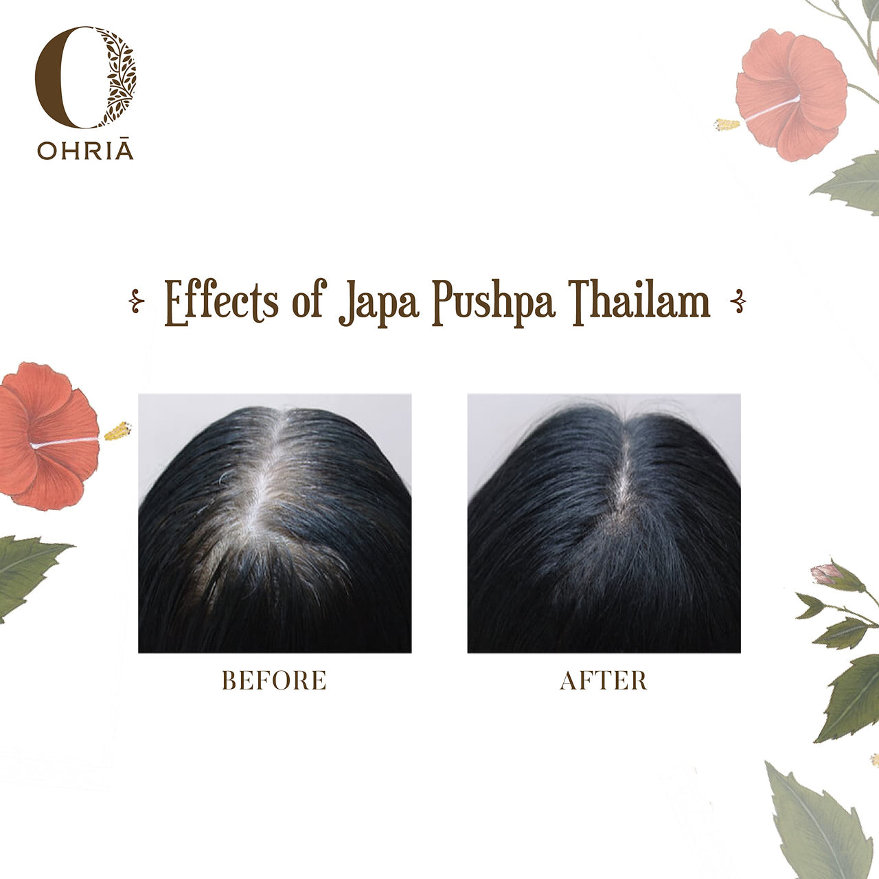 Ohria Ayurveda Japa Pushpa Thailam Hair Oil | Ayurvedic Herbal Blend with Neelibringadi Oil | Supports Hair Strength and Nourishment | For All Hair Types (200 ML)