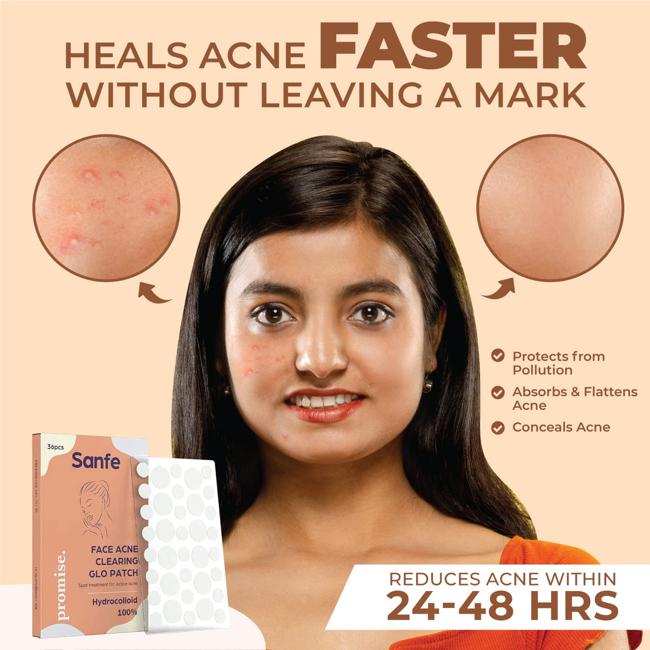 Sanfe Promise Face Acne Pimple Patch - Pack of 72 | Pimple Healing & Spot Clearing Patch | Absorbing Cover |Invisible, Blemish Spot, Hydrocolloid, Skin Treatment