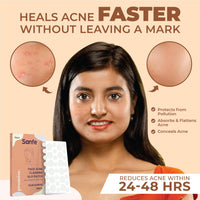 Sanfe Promise Face Acne Pimple Patch - Pack of 72 | Pimple Healing & Spot Clearing Patch | Absorbing Cover |Invisible, Blemish Spot, Hydrocolloid, Skin Treatment