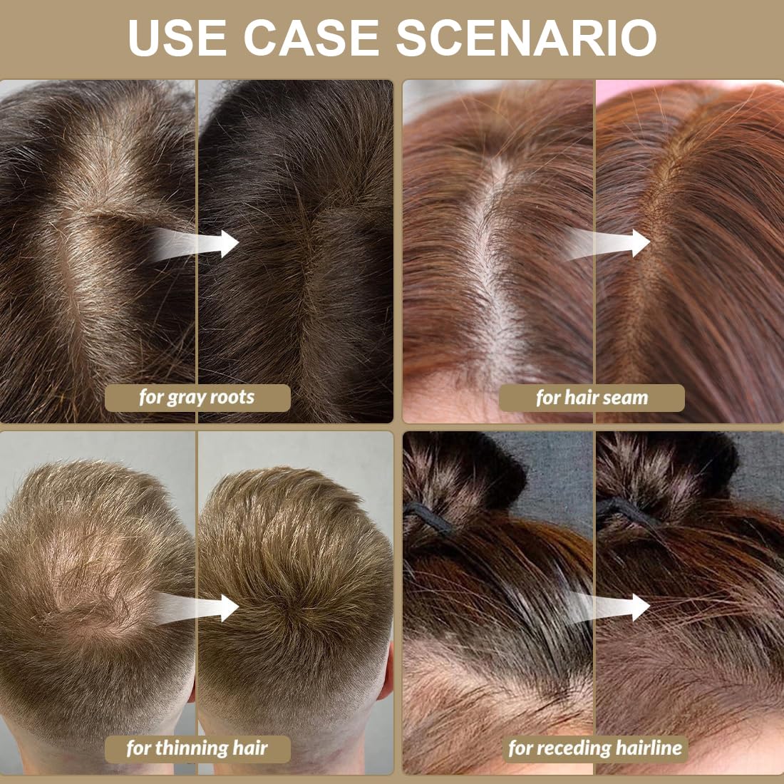 OCEANEVO Hairline Powder For Men And Women, Instant Root Touch Up Color For Grey And White Hair Coverage, Hair Concealer - 4 Grams - Dark Brown