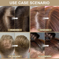 OCEANEVO Hairline Powder For Men And Women, Instant Root Touch Up Color For Grey And White Hair Coverage, Hair Concealer - 4 Grams - Dark Brown
