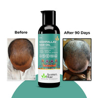Avimee Herbal Keshpallav Hair Oil For Men & Women | Promotes Hair Growth & Reduces Hair Fall | With Rosemary, Castor, Amla, Coconut and Bhringraj Oil | Mineral Oil Free | 100 ml