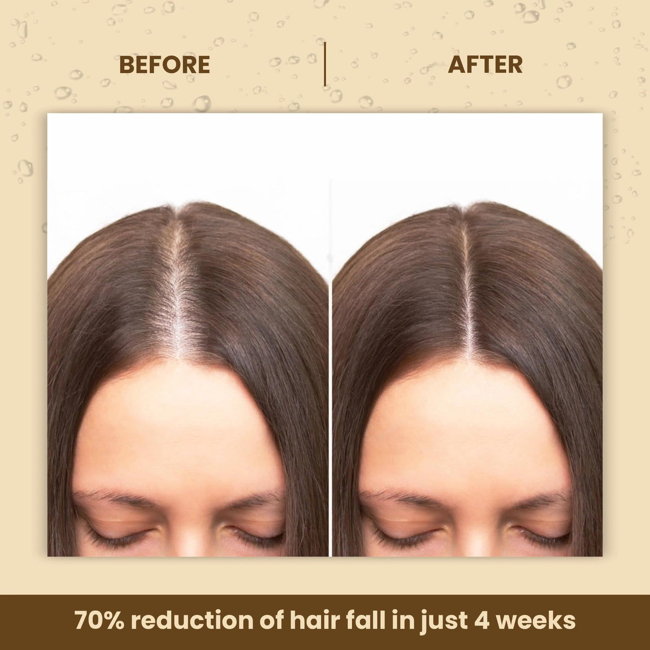 La Pink Methi Dana 8-in-1 Hair Oil For Hair Growth & Thickness | Reduces Hair Fall, Dandruff & Baldness | Enriched with Hibiscus, Bhringraj, Indian Bay Leaf & Onion | 150ml