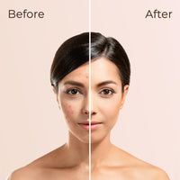 SOKU Fidelity Forever Liquid Buildable Coverage Foundation | With Shea Butter & Vitamin E | For All Skin Types | Satin Finish, Long-Lasting with a Silky Texture (Cameo-01) - 30ml