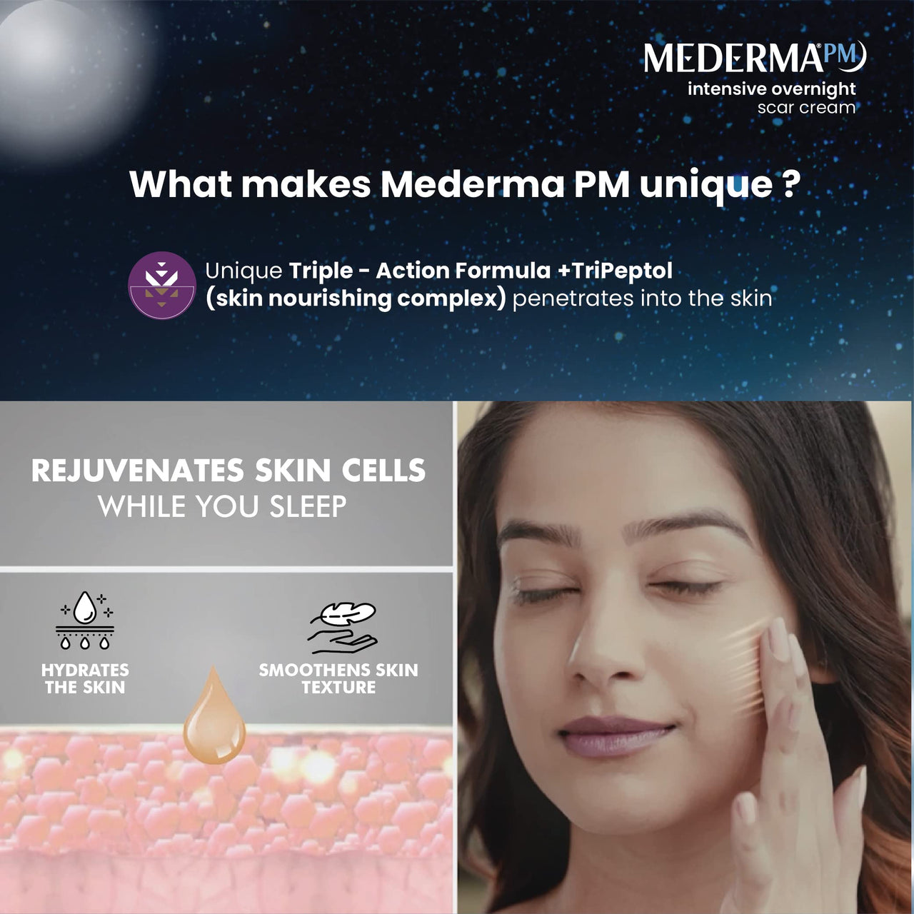 Mederma PM Old & New Acne Scar Removal Cream 30g