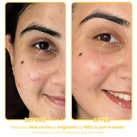 THE SKIN DIET COMPANY Banana Under Eye Cream | Reduces Dark Circle, Puffiness and Fine Lines | With Niacinamide | For Women & Men (15ml)