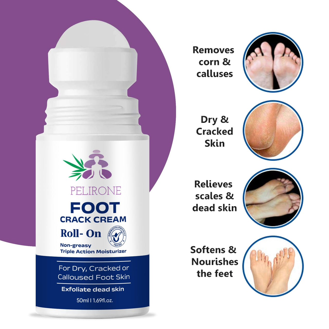 PELIRONE Urea Foot Cream Roll-On 50ml – 20% Urea with 2% Lactic Acid, Olive Oil & Vitamin E for Deep Moisturizing and Repair of Dry, Cracked Heels and Feet