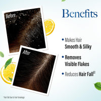 Kesh King Ayurvedic Anti-Dandruff Shampoo | Reduces hair fall | Soothes itchy scalp | No Paraben & No Silicon | 21 natural ingredients | Enriched with curd, lemon & neem | 600 ml