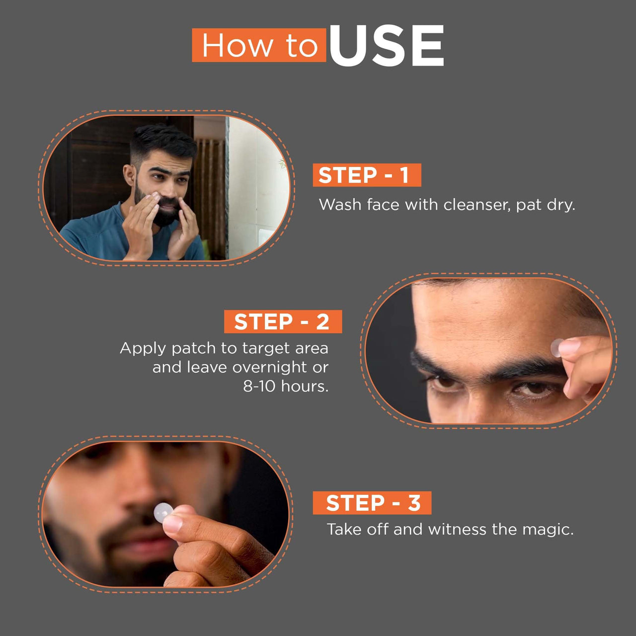 Beardhood Acne Pimple Patch | 72 Hydrocolloid Waterproof Patches | For Active Surface Acne | Absorbs Pimple Overnight, Reduces Excess Oil | For All Skin Types