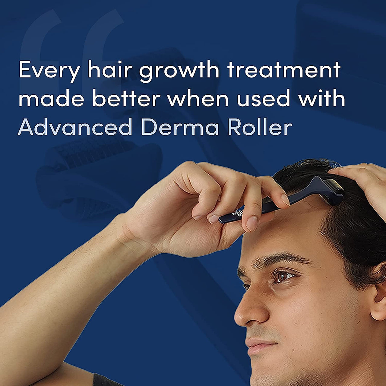 Man Matters Advance Derma Roller with Disinfectant | For Scalp & Beard | 540 Micro 0.5mm Titanium Alloy Needles | Reduces Hair Fall, Stimulates Hair Follicles | Safe & Effective
